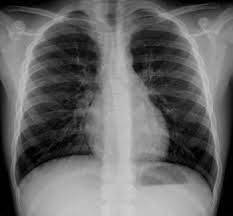 Diagnostico por imagenes